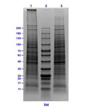 SDS-Page of HEK239 Whole Cell Lysate.<br />Lane 1: Reduced HEK239 Whole Cell Lysate [10 μg].<br />Lane 2: Opal Prestained Molecular Weight Marker.<br />Lane 3: Non reduced HEK239 Whole Cell Lysate [10 μg].<br />4-20% SDS-PAGE gel, Coomassie Stained.